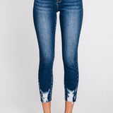 Dark High Rise  Skinny Jeans